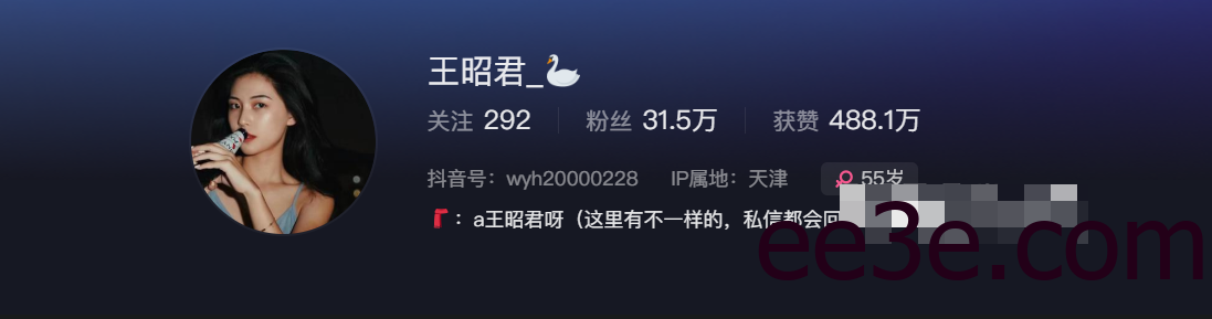 抖音网红王昭君呀微密圈精选作品资源来了